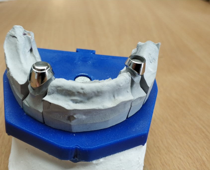 Stiftaufbau mit integriertem Magnet