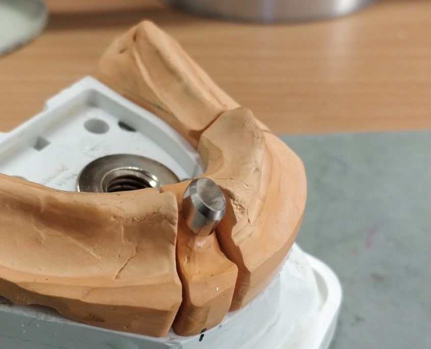 Stiftaufbau aus magnetischer Legierung